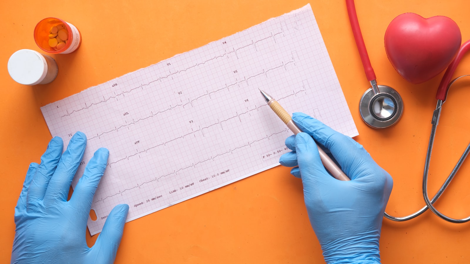 Atrial Fibrillation